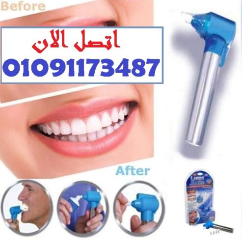 تنضيف احترافي وانت في بيتك 💯 مع Luma Smile – جهاز تلميع الأسنان السريع