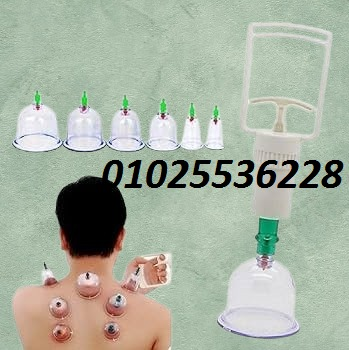حجامة إسلامية طبية – طقم 6 قطع
