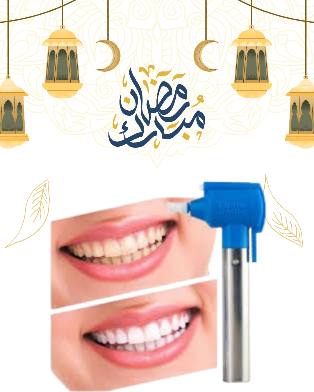 “احصل على أسنان نظيفة كالمحترفين مع جهاز Luma Smile”01140963128